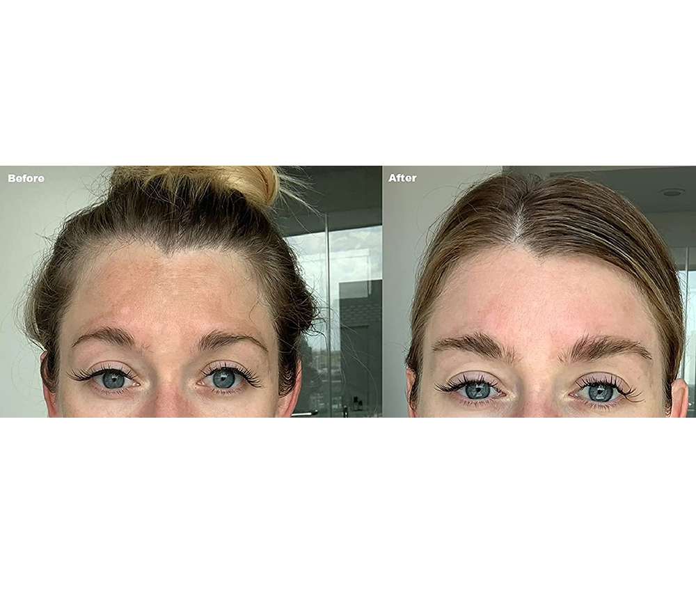 Oem Pigmentation Freckle Brightening Whiting Anti Aging Face Serum Skin Care Whitening Dark Spot Removal Corrector Serum Facial