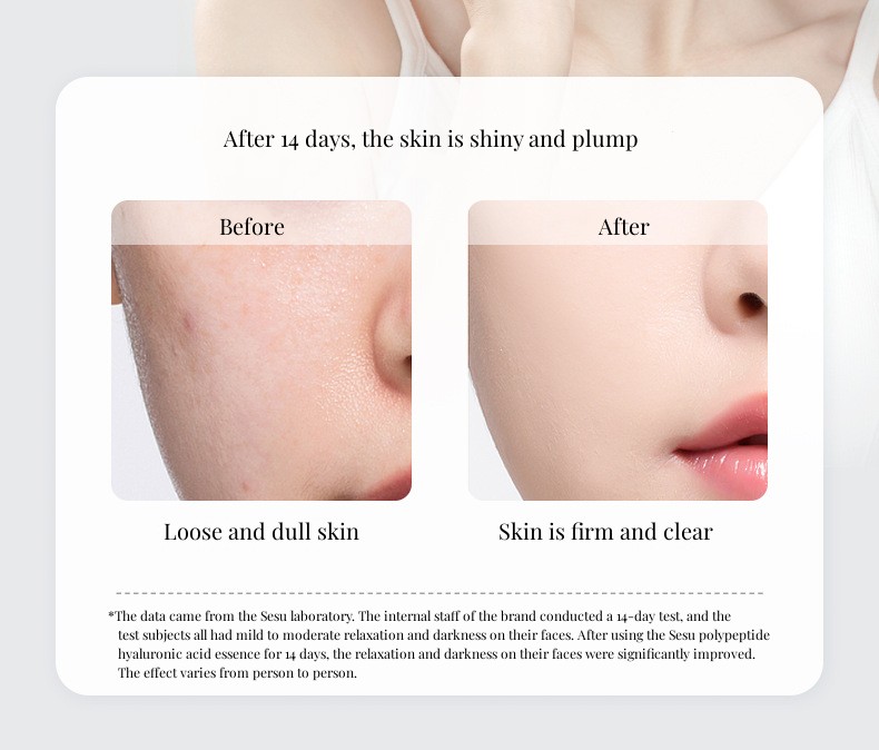 Polypeptide Hyaluronic Acid Serum Detail 10