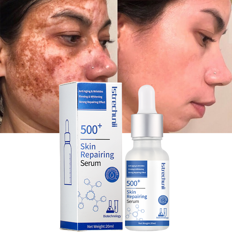 Wholesale Custom Microbial Fermentation Skin Care Anti-Wrinkle Firming Whitening 500+ Face Serum For Repair Skin Texture