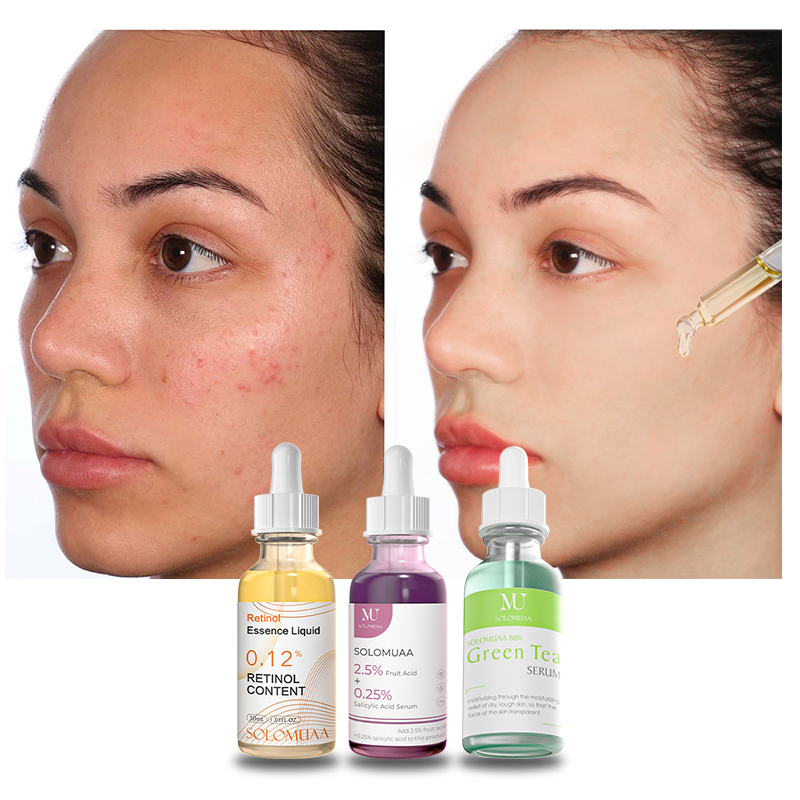 Tranexamic Acid Vit c Retinal Copper Peptide Gold Pore Refining Collagen Face Oil Vitamin c Retinol Facial Private Label Serum