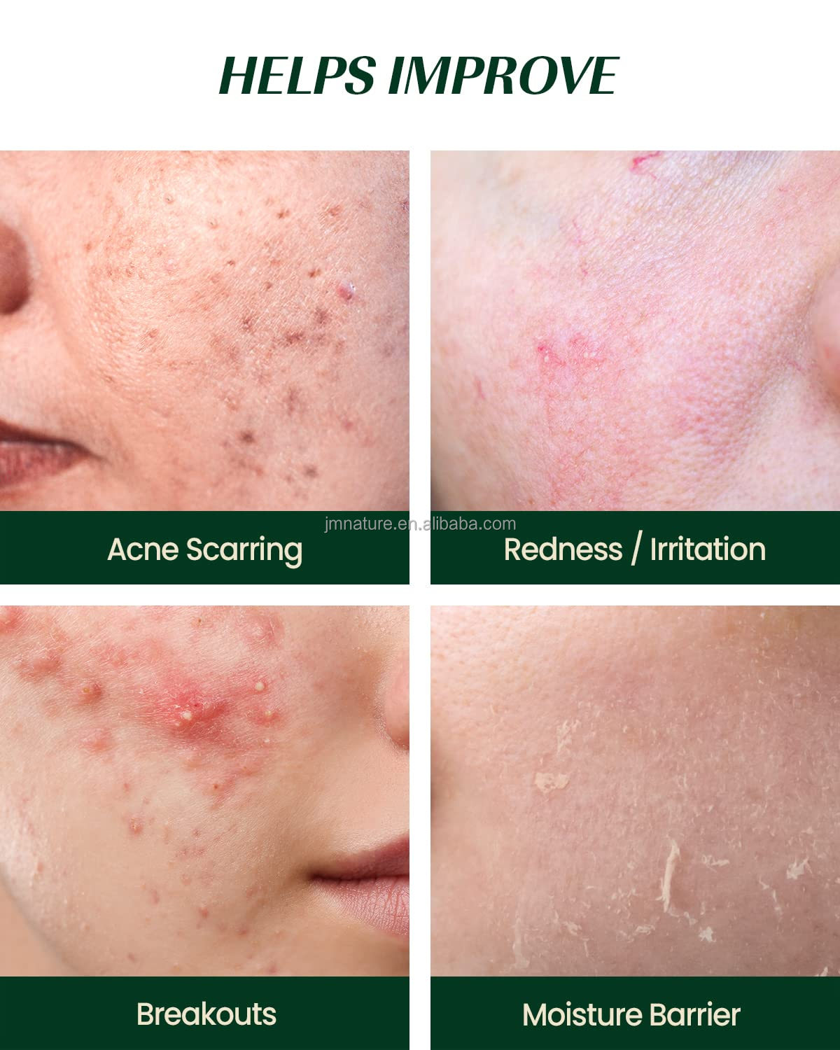Private Label 2% Salicylic Acid Solution Aloe Vera Based Exfoliating Serum for Face Acne &amp; Hyper-Pigmentation Treatment
