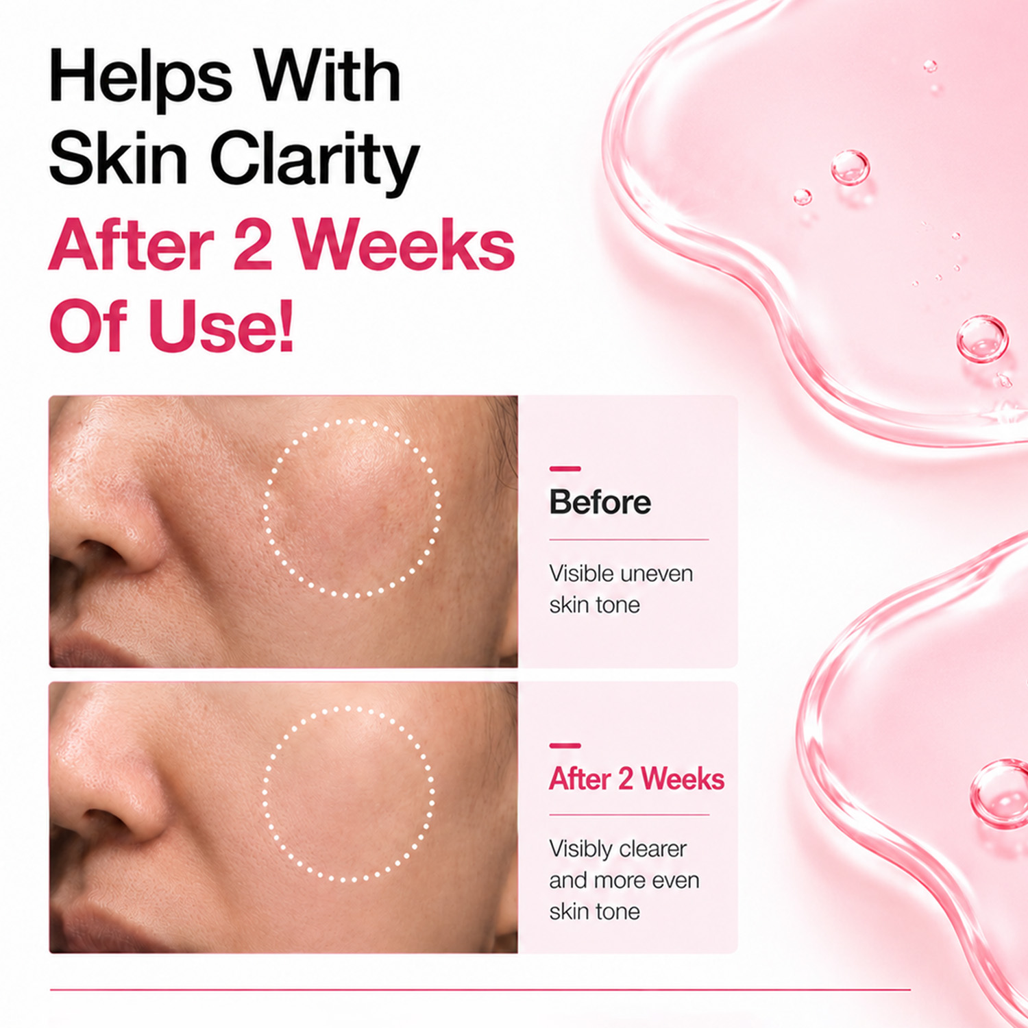 Private Label 30ml 10% Niacinamide 4% TXA Tranexamic Acid Face Serum Dark Spot Corrector Hydrating Brightening Skin Care OEM ODM