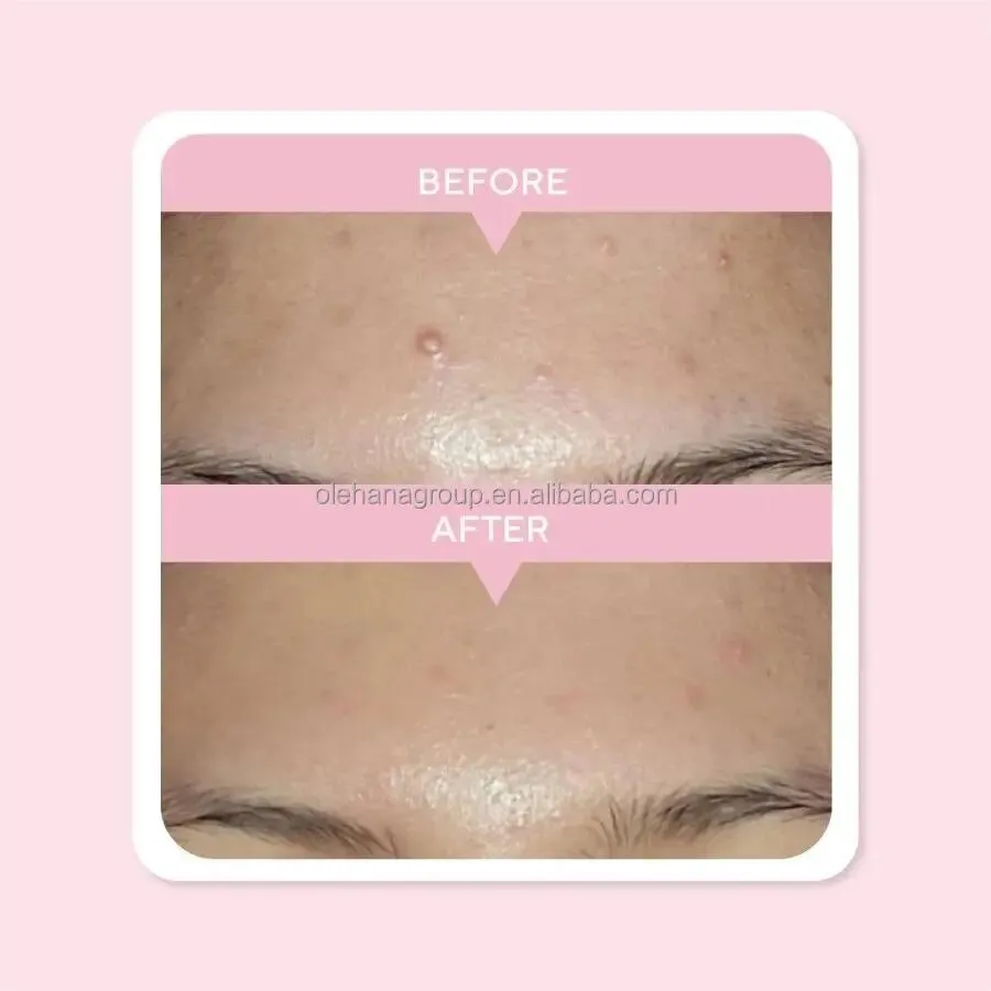 Private Label OEM/ODM Beauty Skin Care Serum 10% Niacinamide Oil Controls Brightening Whitening Face Serum