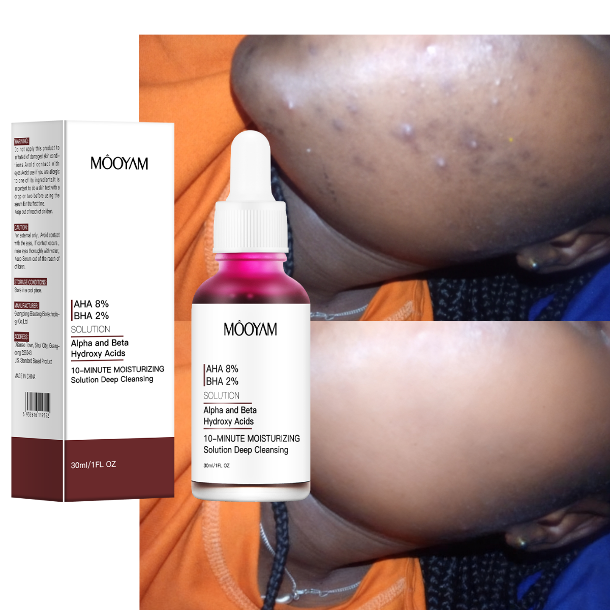 Hot Sale 10-minutes Exfoliating Solution Deep Peeling 8% AHA+ 2%BHA Face Serum Private Label OEM MOOYAM Beauty Facial Serum