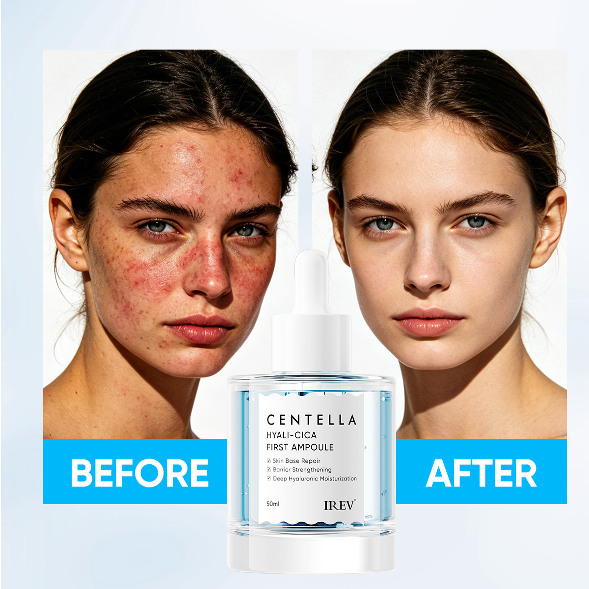 IREV Centella Hyali-Cica Anti-Aging Niacinamide Hydrating Moisturizing Skin Base Repair Face Serum First Ampoule Private Label