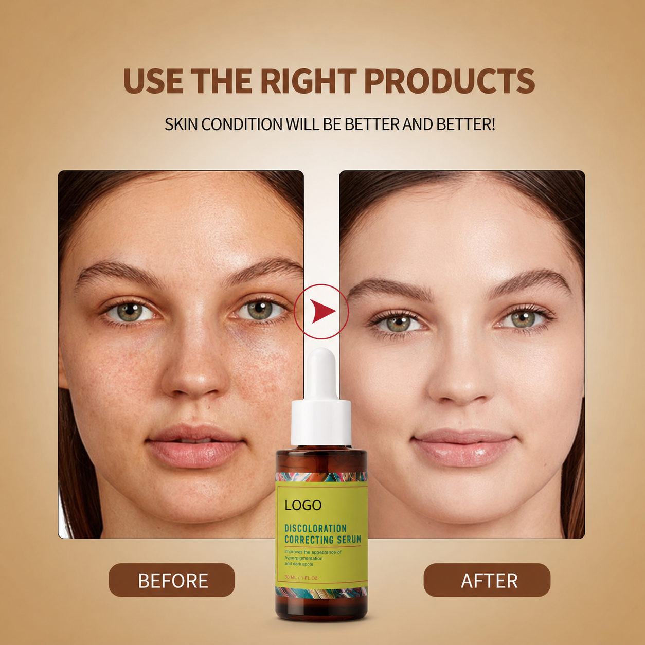 Organic 30ml Niacinamide PropanediolGlycerin Serum for Tranexamic Acid Azelaic Acid Dark Spots Sun Damage Age Spots Treatment