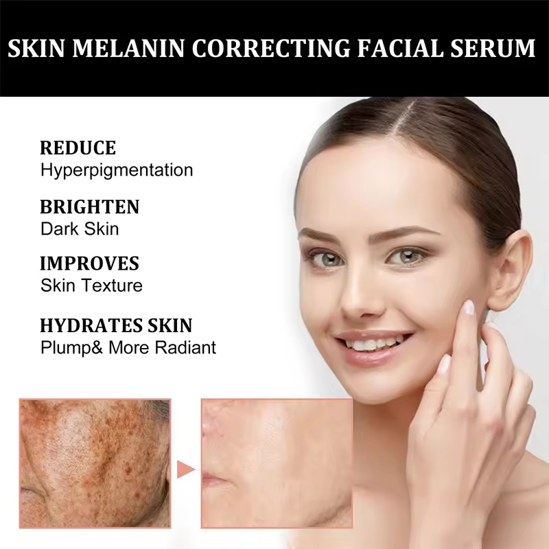 Private Label Body Melanin Correction Serum Moisturizing Firming Brightening Pigmentation Reducing Black Spot Fading Home Use