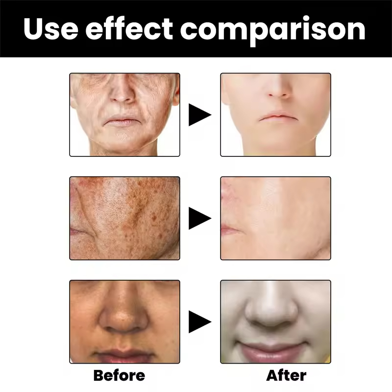 Private Label Body Melanin Correction Serum Moisturizing Firming Brightening Pigmentation Reducing Black Spot Fading Home Use