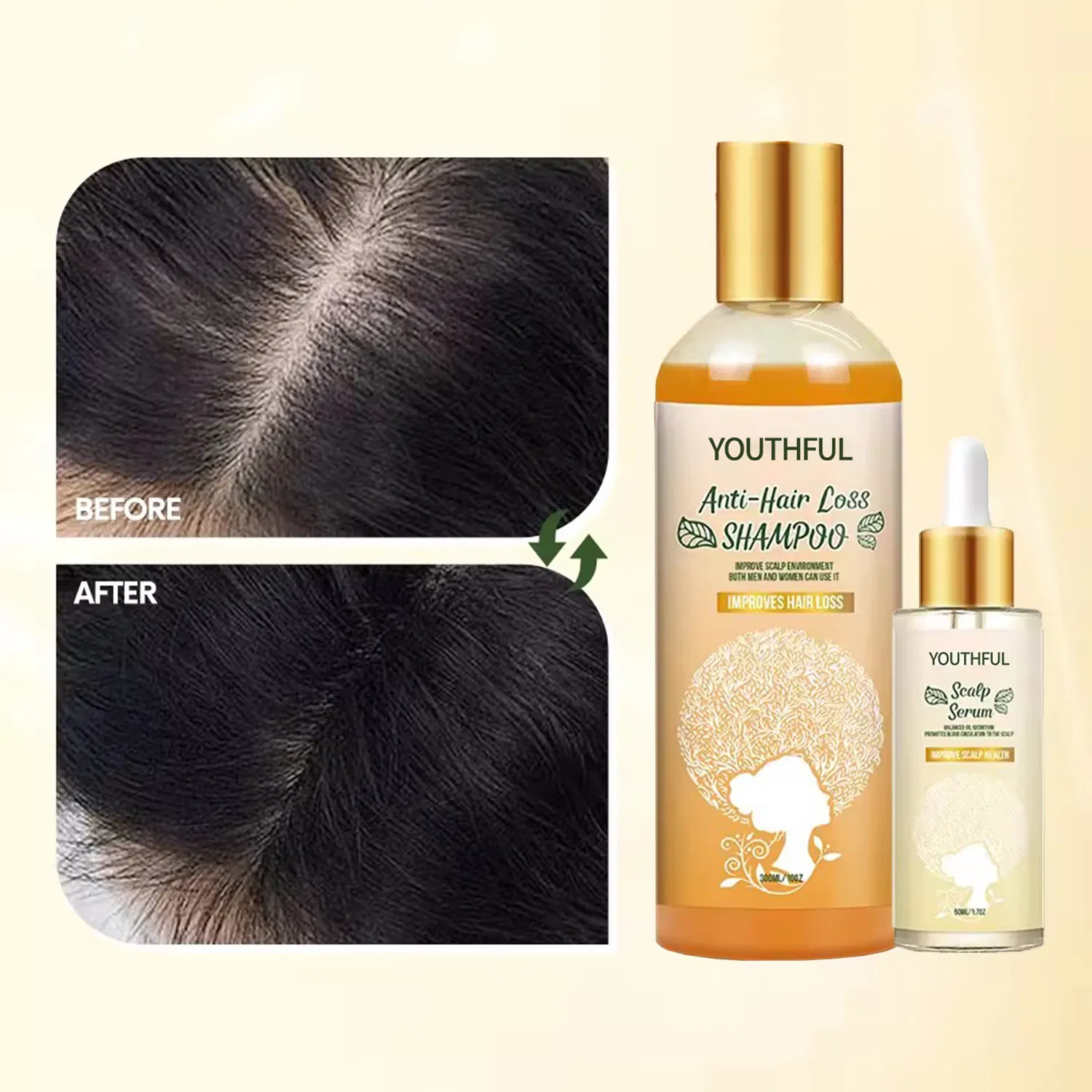 Hair Treatment Products Anti Hair Loss Scalp Oil Control Serum