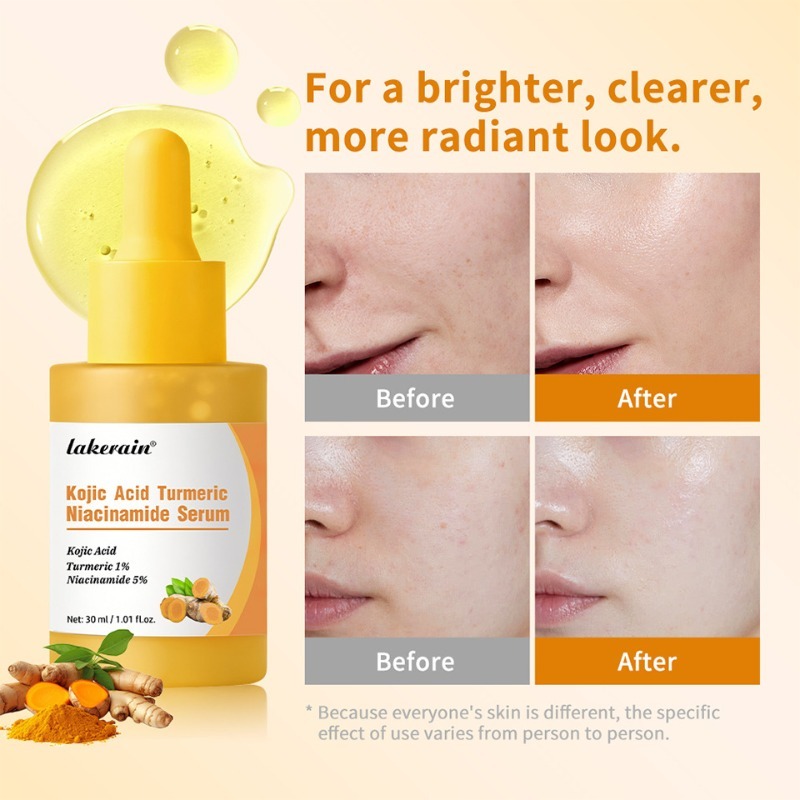 Kojic Acid Turmeric Niacinamide Serum 30ml Moisturizer for Facial Skin Care Customized for Uniform Tone Anti-Aging Firming Face
