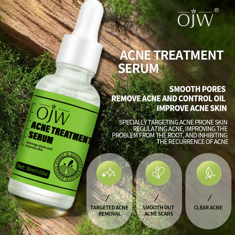 Natural Face Anti Pimple Scar Remover Herbal Acne Treatment Facial Serum