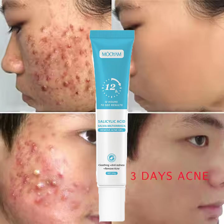 Fast Effective Repair Pimple Scar Anti Spots Removal Collagen Gel Moisturizing Anti-Wrinkle Smooth Skin Shrink Pores Treatment