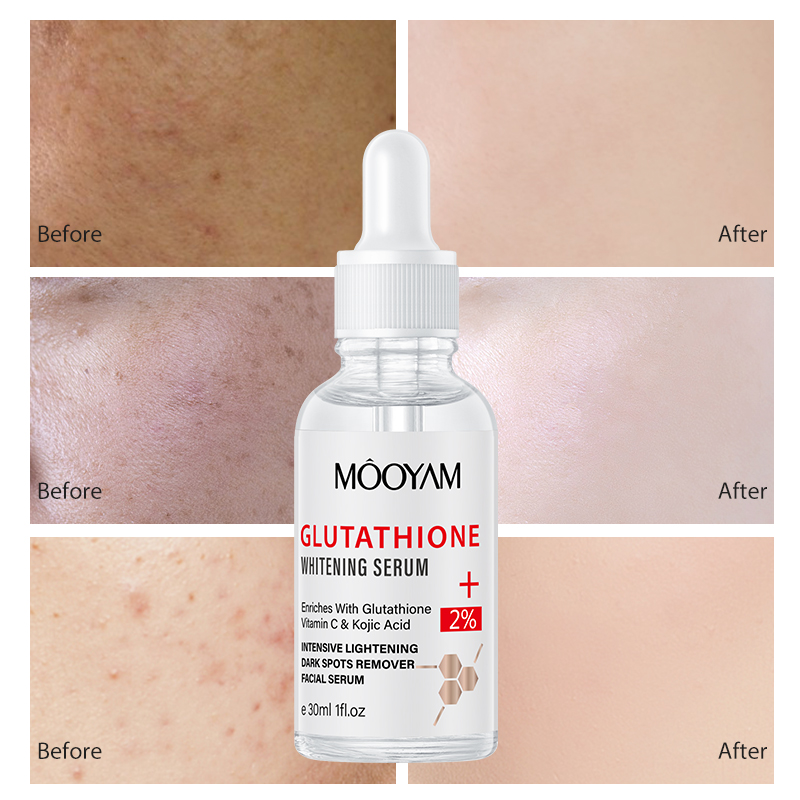 OEM Strong Whitening Capsule Corrector Antioxidants Anti-Aging Moisturizer Remove Melasma Improve Skin Firmness WHITE SERUM