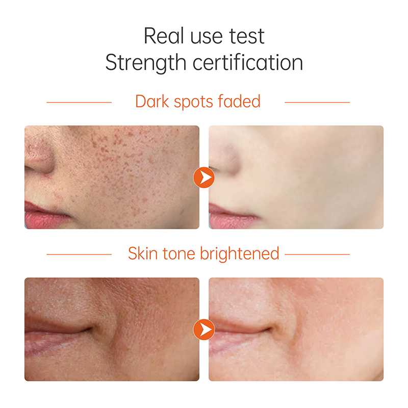 Korean Skin Care Anti Aging Brightening Dark Spot Remover Organic Vitamin C Face Serum for Women