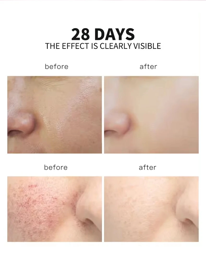 OEM 5 in 1 Vitamin C Essence Retinol Niacinamide Anti-Aging Facial Brightening Serum for All Skin Types