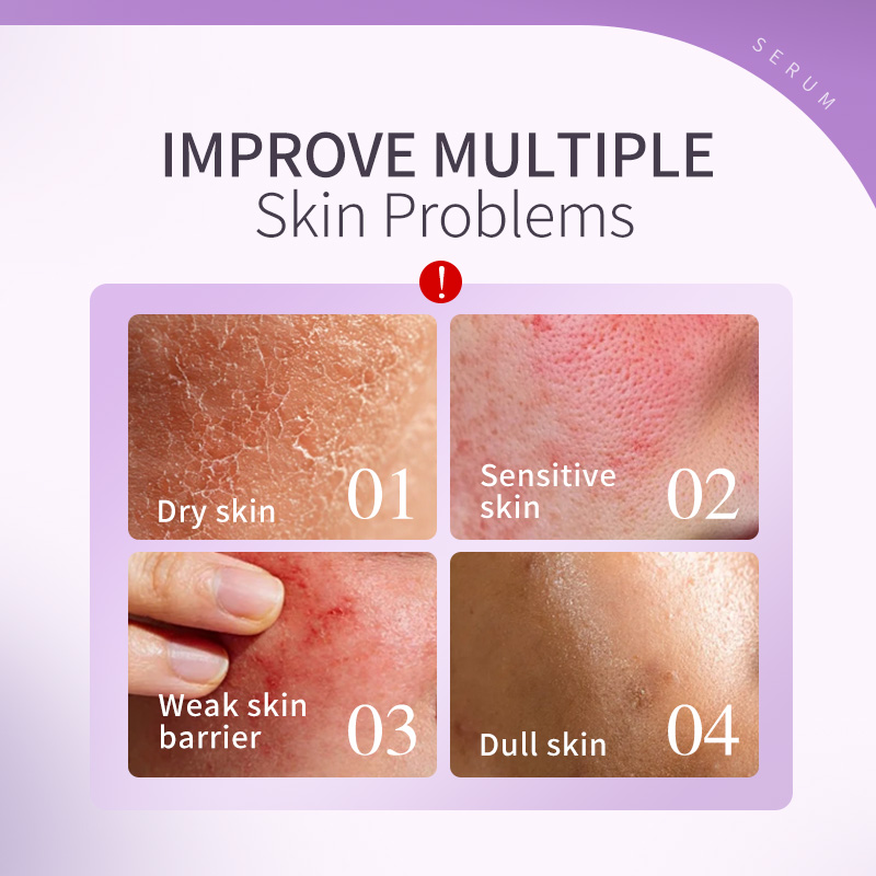 OEM Ceramide Niacinamide Barrier Strengthening Serum Restoring Hydrating Calming for Dry Damaged Sensitive Skin