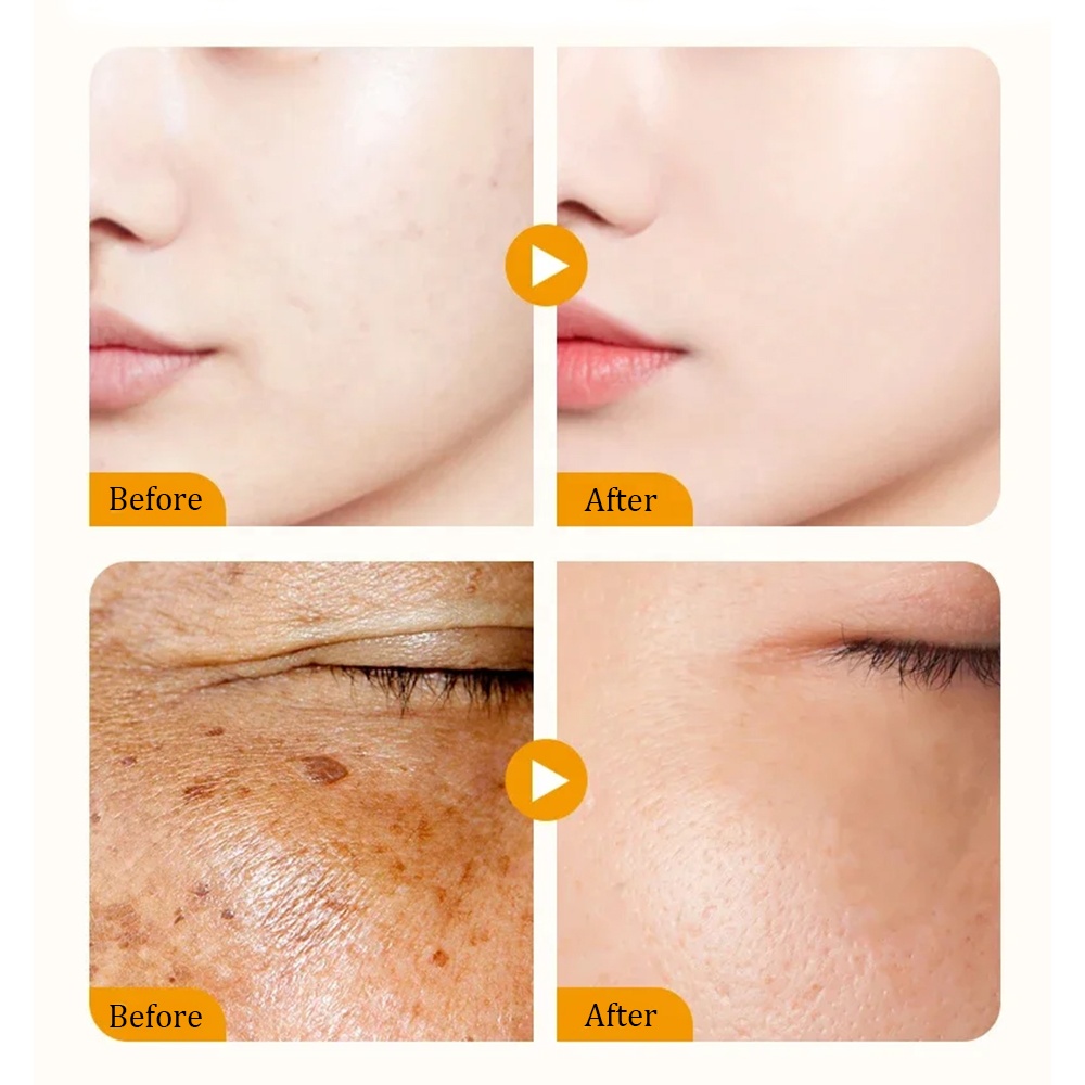 Serum Detail