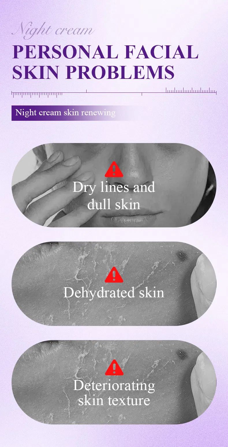 Hydrating Night Cream with Nicotinamide for Overnight Skin Renewal