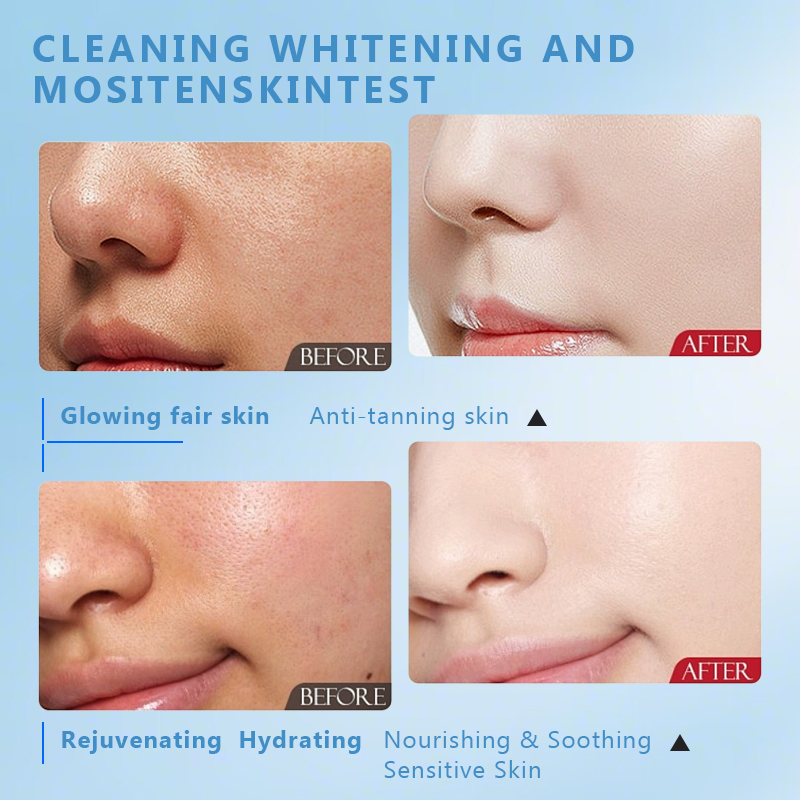 Tranexamic Acid Transamin Brightening Serum Dark Spot Corrector for Hyperpigmentation Melasma Face Care 30ml Private Label