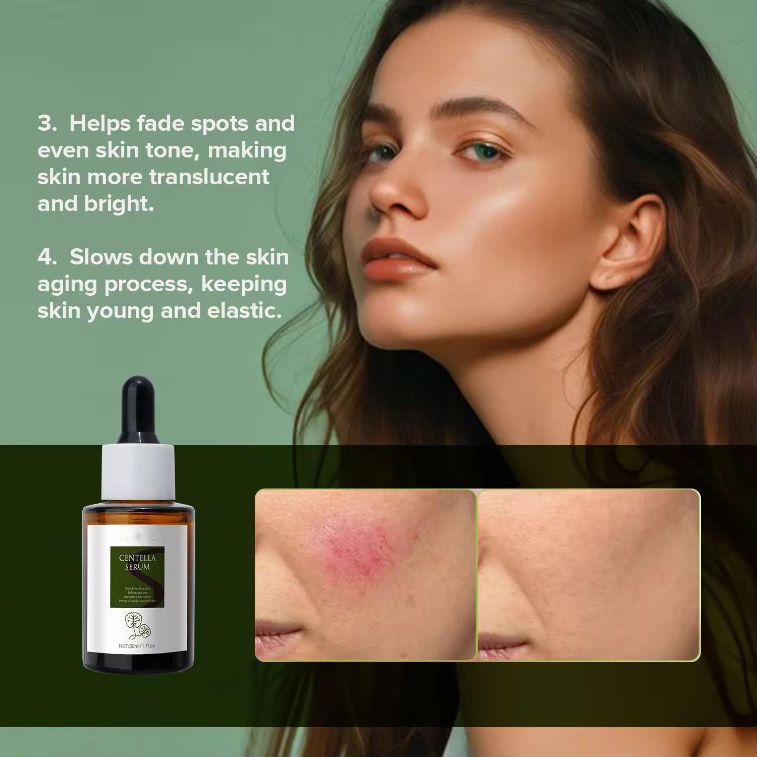 Private Brand Natural Centella C Serum Hyaluronic Acid-Based Face For Essence For Acne Treatment Soothing Sensitive Skin Home
