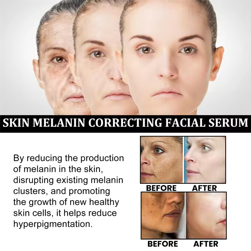 Private Label Body Melanin Correction Serum Moisturizing Firming Brightening Pigmentation Reducing Black Spot Fading Home Use