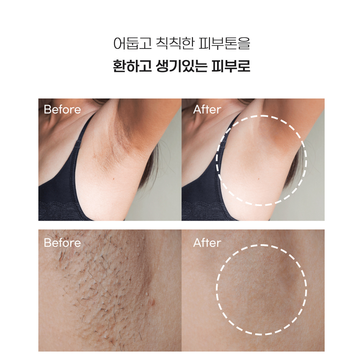 Blue Petal Dark Spot Corrector