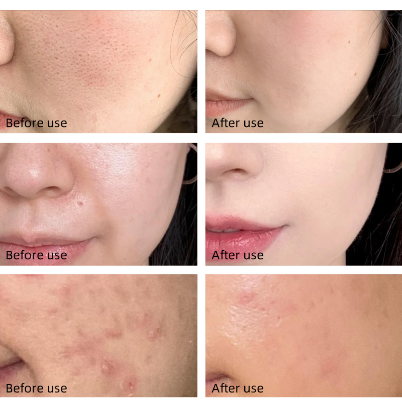 Mandelic Acid AHA Gentle Exfoliating Serum Beginner Friendly Rough Dull Uneven Skin Care Gentle Exfoliating Skin Refining Care