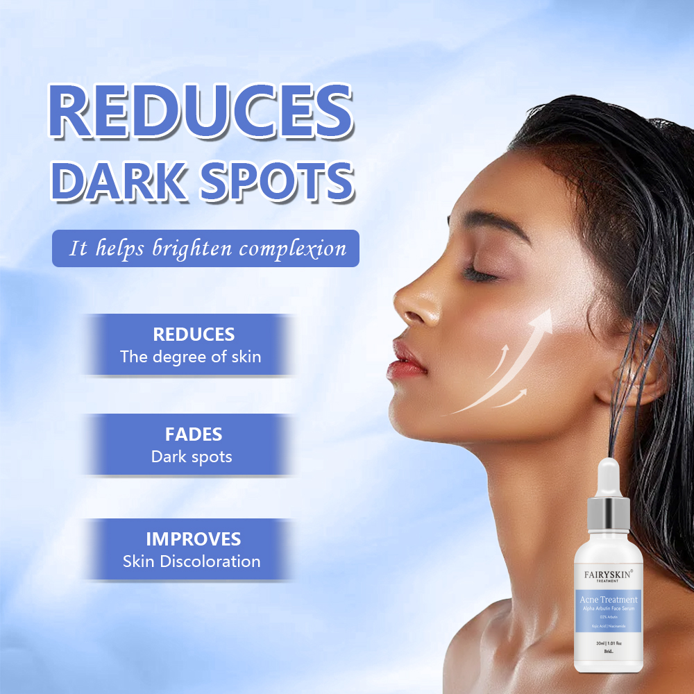 OEM Anti Acne Serum for Skin Care Kojic Acid Private Label Whitening Alpha Arbutin Face Serum for Anti Acne Products
