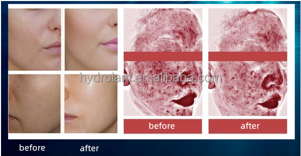 PDRN Serum
