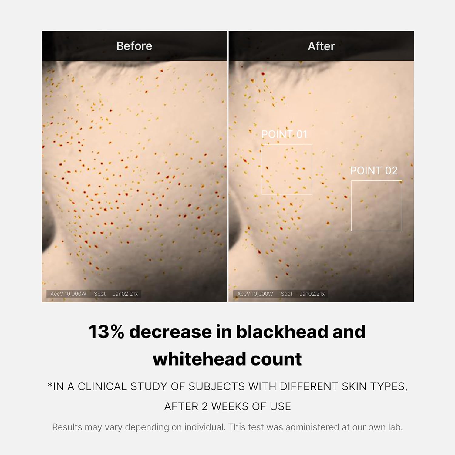 Medicube Zero Pore One-day Serum Overnight Resurfacing Reduction in Pore Appearance After One Day of Use Serum
