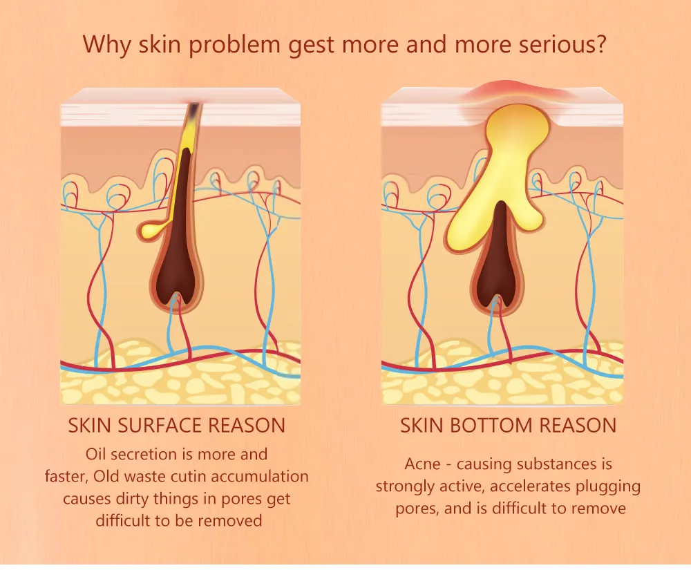 Pore Minimizer Face Serum Multi-Step Solution for Shrinking Pores, Cleansing, Oil Control Serum