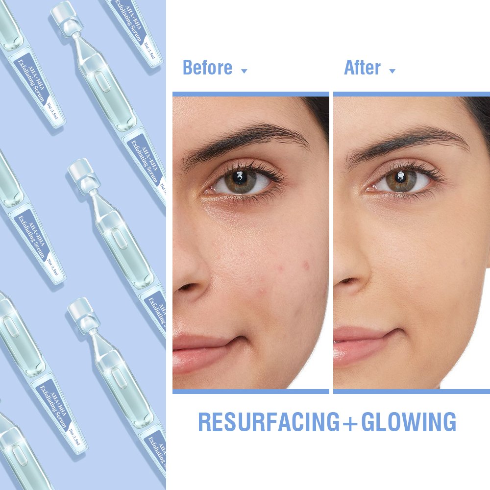 Kangrong Private Label Whitening Aloe Vera Acne Scar Resurfacing Exfoliating AHA BHA Salicylic Kojic Acid Facial Serum Ampoules