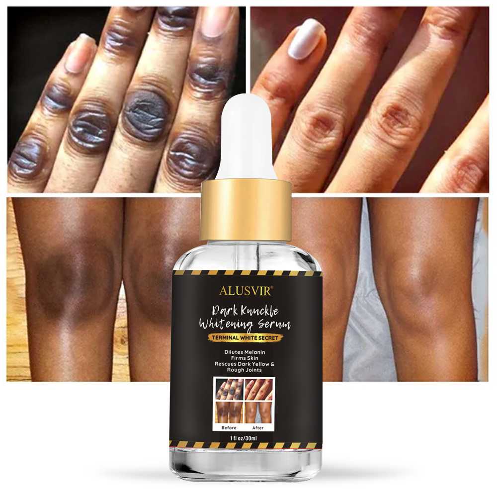 Korean Cosmetics Strong Dark Knuckle Body Whitening Serum Dark Spot Correcting Remover Glow Skin Care Serum Liquid Face Female