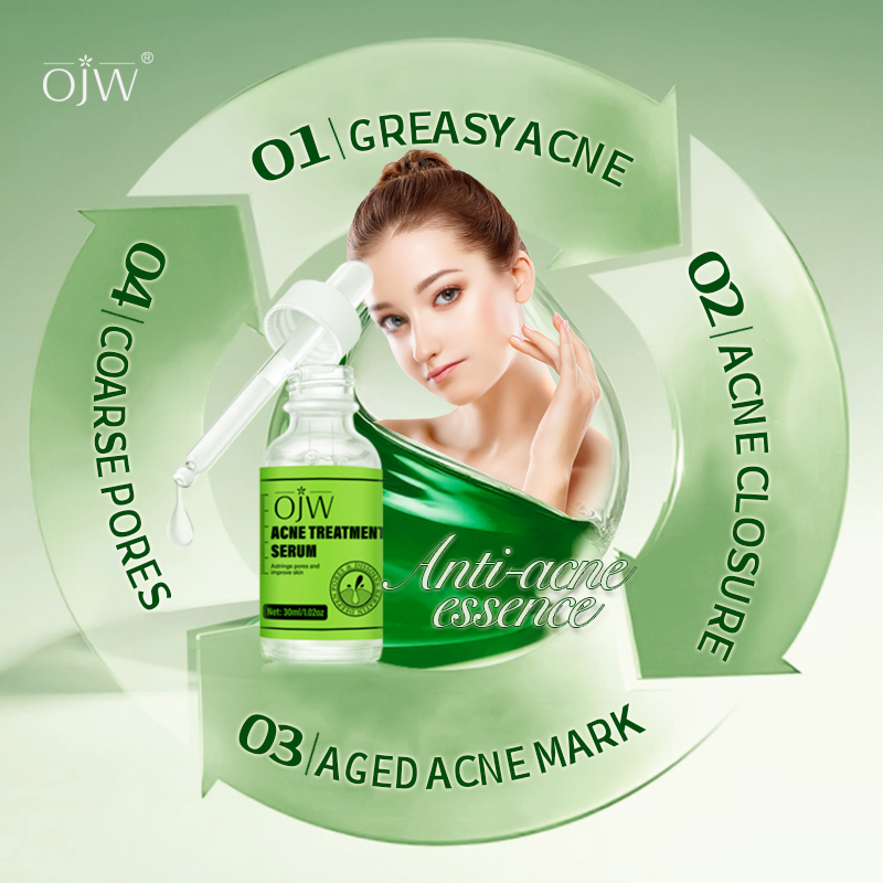 Acne Serum 4