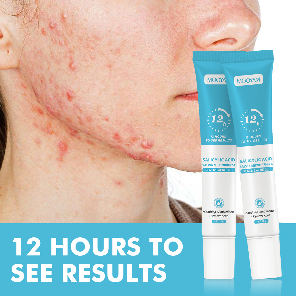 Fast Effective Repair Pimple Scar Anti Spots Removal Collagen Gel Moisturizing Anti-Wrinkle Smooth Skin Shrink Pores Treatment