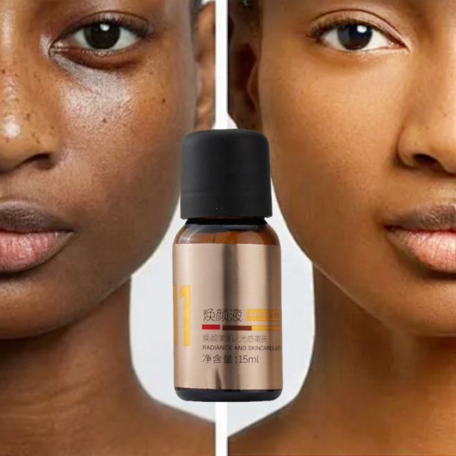 Salicylic Acid Melasma Instant Remover Peel Serum Dark Spot Correction Skin Peeling Solution Chemical Peel for Face Professional