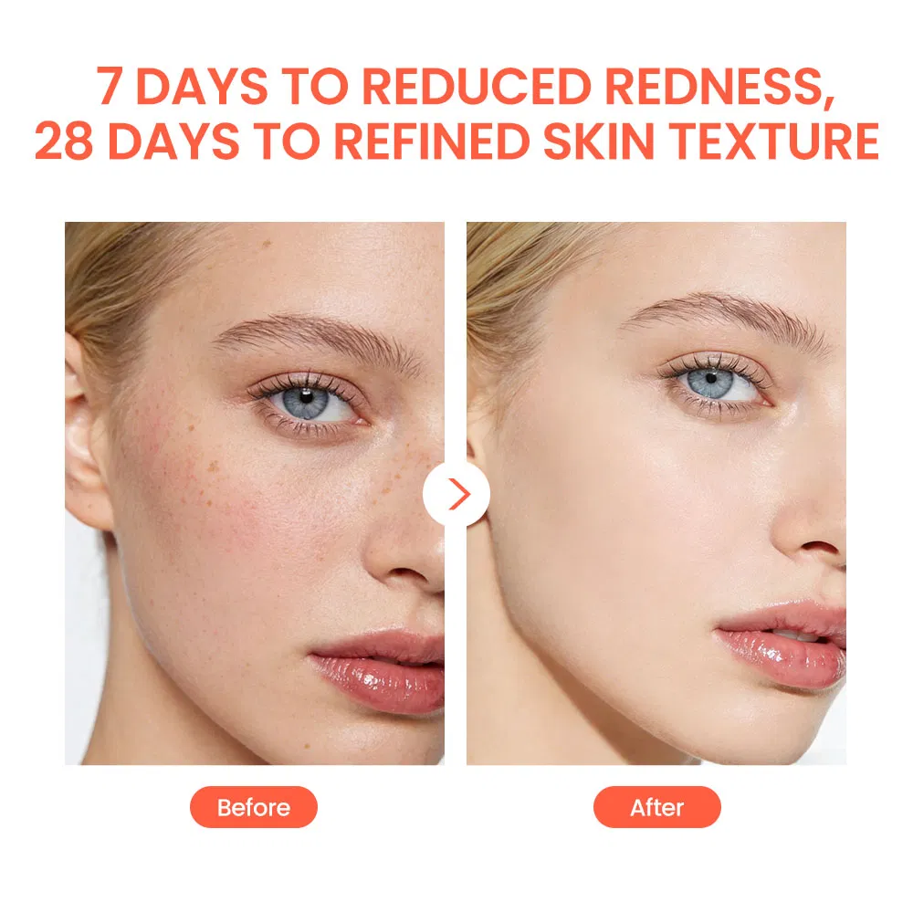 Snail Collagen Anti-Wrinkle Moisturizing Essence Firming Face Snail Facial Serum Beauty Personal Care