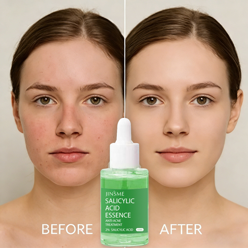 Salicylic Acid Serum Image 4