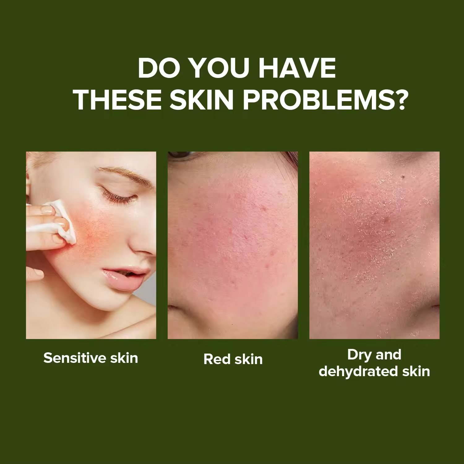 Private Brand Natural Centella C Serum Hyaluronic Acid-Based Face For Essence For Acne Treatment Soothing Sensitive Skin Home