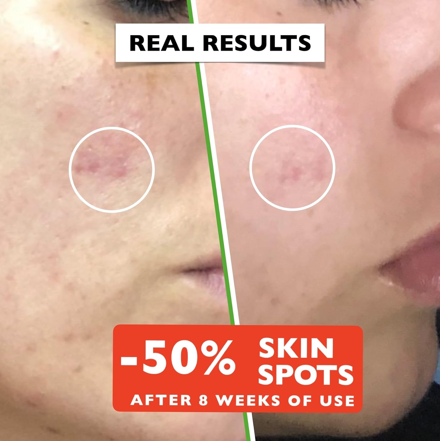 Private Label Vitamin C Hyaluronic Acid Serum Brightening Moisturizing Skin Essence Face Serum for Dry Sensitive Skin