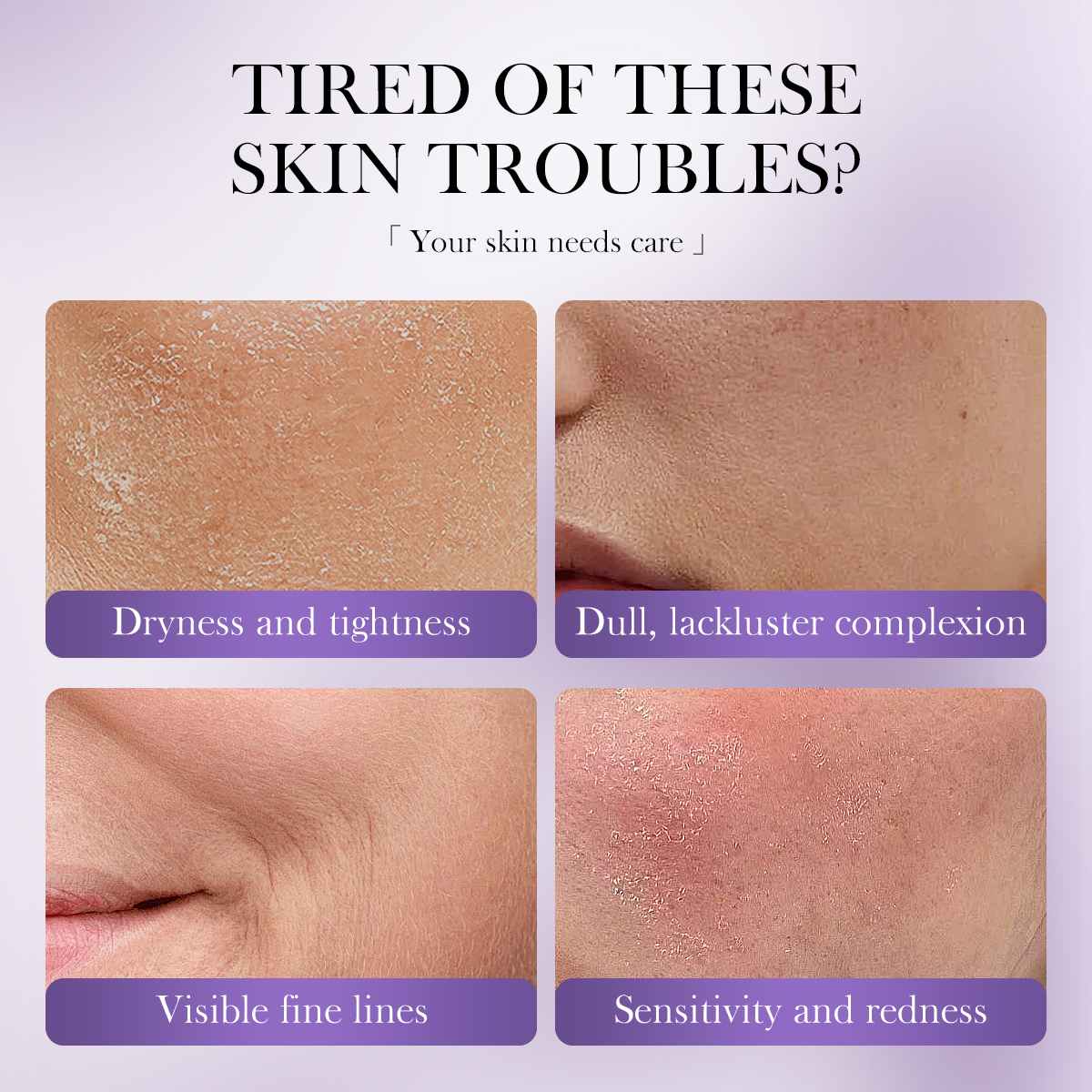 Vegan Sensitive Skin Hydrating &amp; Plumping Ceramide Skin Barrier Repair Black Rice Probiotics 2% NAD+ Serum Mist