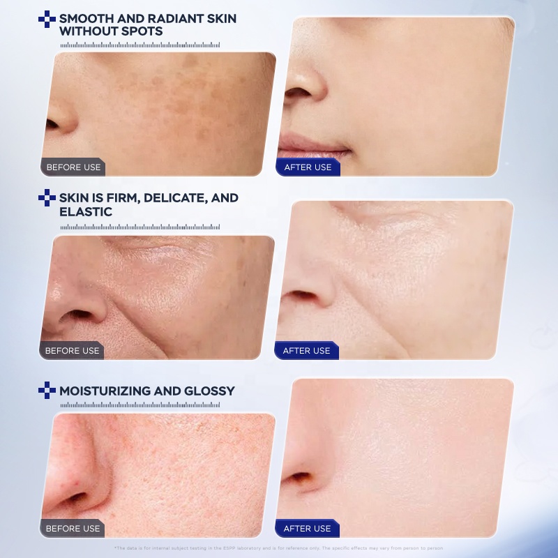 ESCP Whitening Face Serum 30ml Dark Spot Corrector Brightening Anti Pigmentation Essence for All Skin Types Wholesale