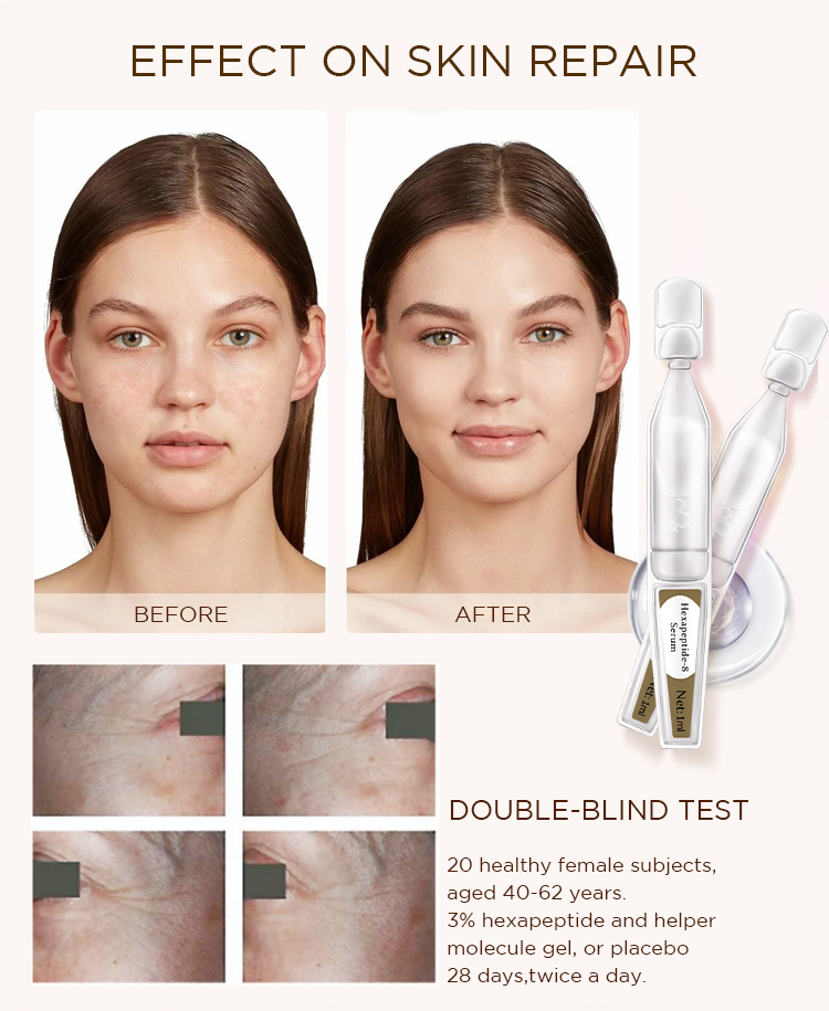 OEM ODM Wholesale Anti Aging Wrinkle Remove Fine Lines Six Peptide Firming Lifting Moisturizing Face Facial Serum Ampoules