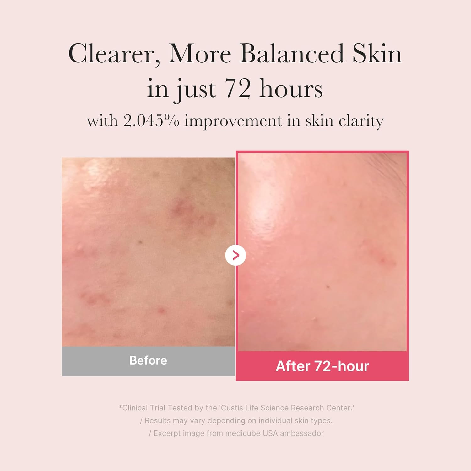 Medicube TXA+Niacinamide 15% Glow Facial Serum For After Spot Care | All-in-One Daily Korean Skincare | Uneven Skin Tone,Texture