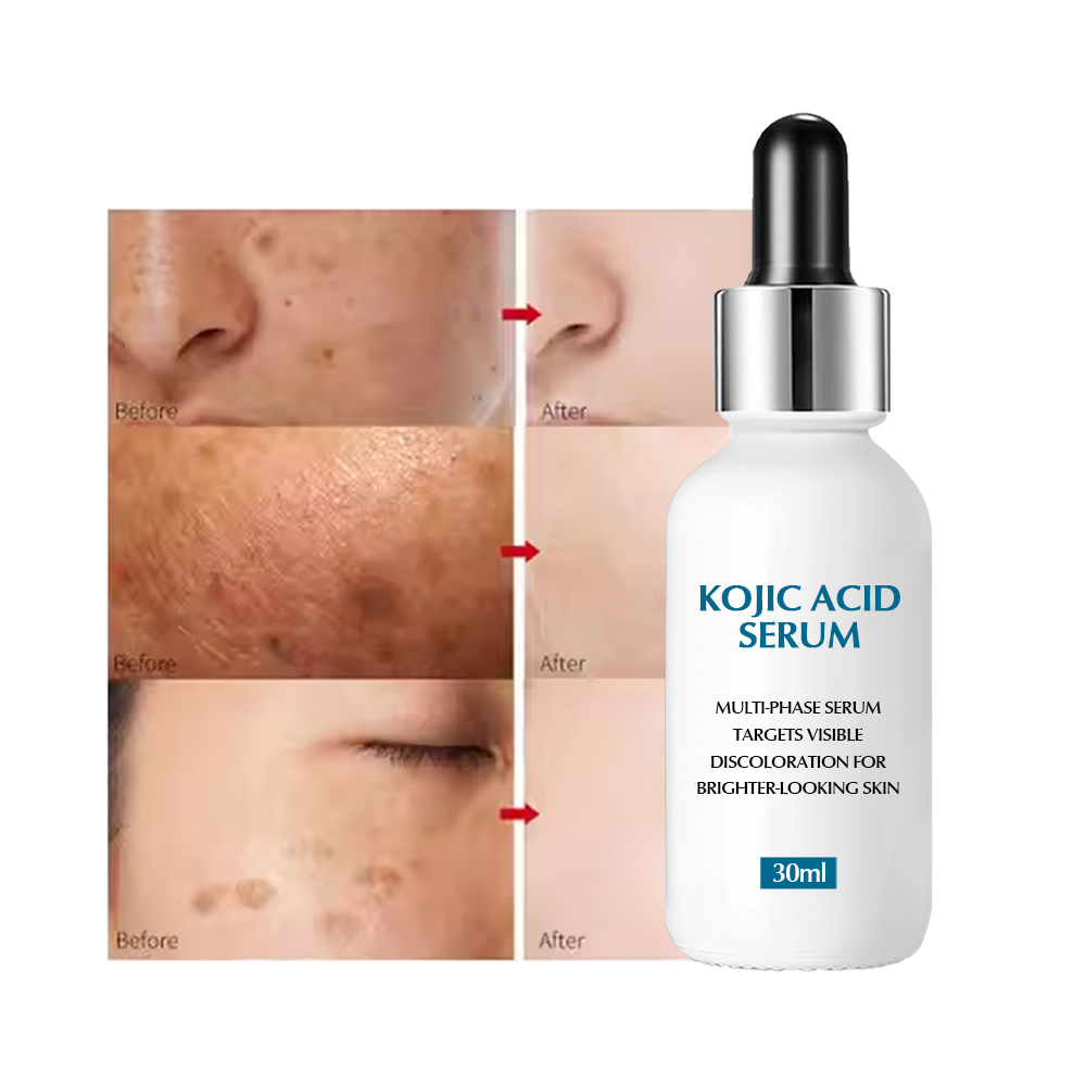 Private Label Freckle Lightening Skincare Korean Face Whitening Whiting Dark Spot Removal Remover Corrector Kojic Acid Serum