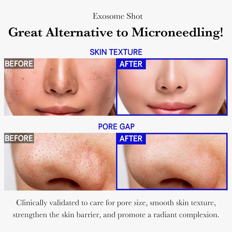 G Facial Serum Glass Skinintensive Glow Serum Skin Restoration Recovery Hydrating Moisturizing Firming Korean Skincare