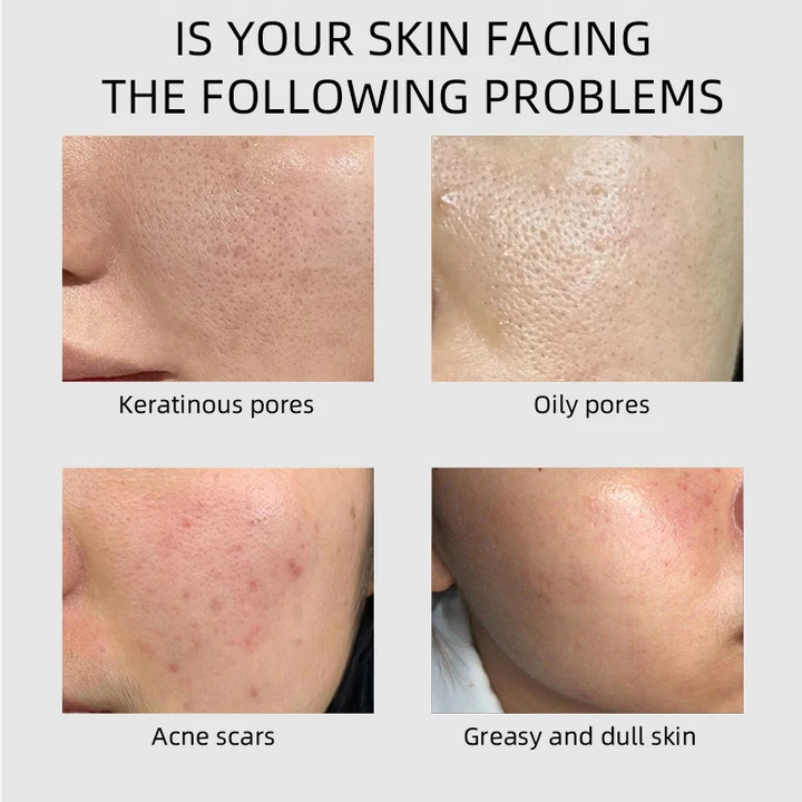 Mandelic Acid AHA Gentle Exfoliating Serum Beginner Friendly Rough Dull Uneven Skin Care Gentle Exfoliating Skin Refining Care