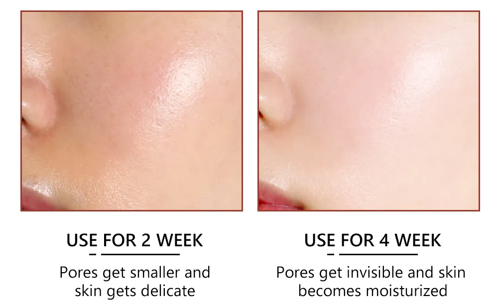 Pore Minimizer Face Serum Multi-Step Solution for Shrinking Pores, Cleansing, Oil Control Serum