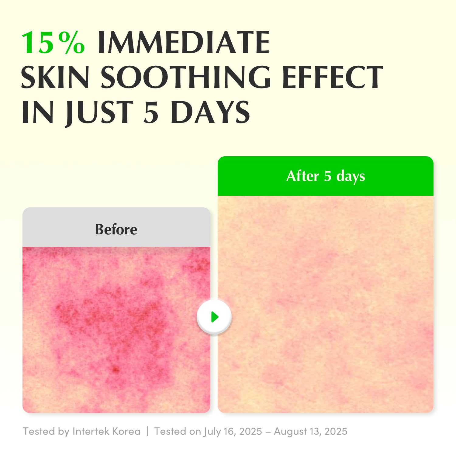 Wholesale Aloe PDRN Calming Smoothie Serum Soothing Korean Skin Care Sensitive Skin Cica Anti-wrinkle Repair Hydrating Face