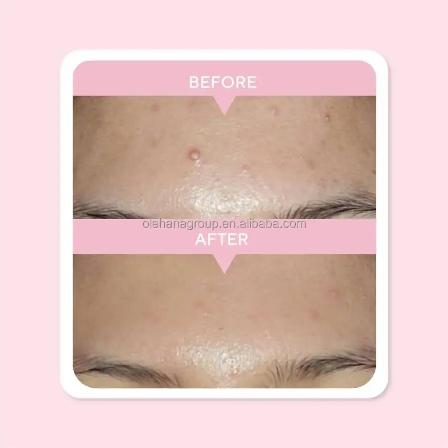 Private Label OEM/ODM Beauty Skin Care Serum 10% Niacinamide Oil Controls Brightening Whitening Face Serum